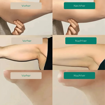 LYMPH-DRAINAGE