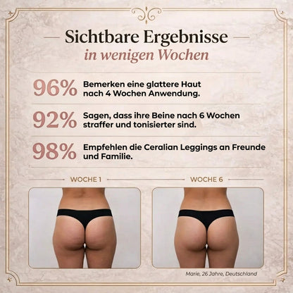 3D Anti-Cellulite Leggings — Formt & Strafft